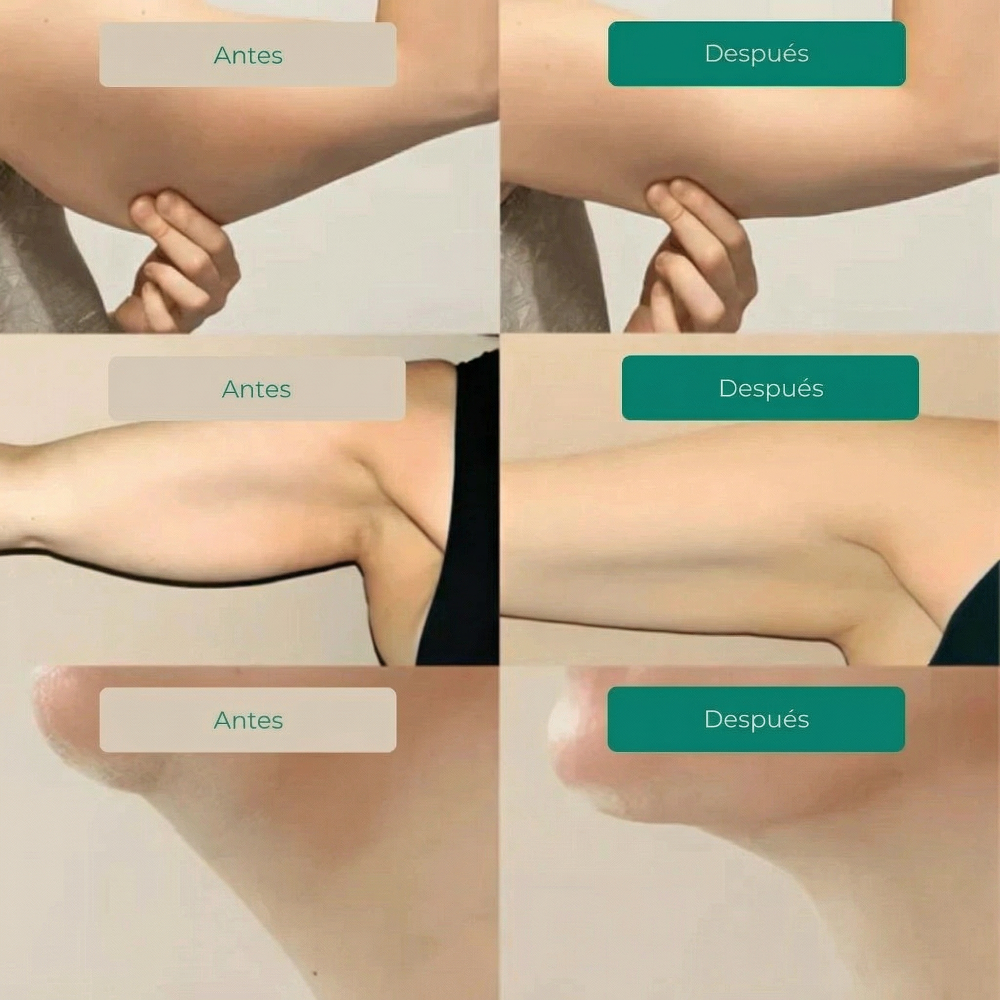 Gotas de Bienestar para Drenaje Linfático