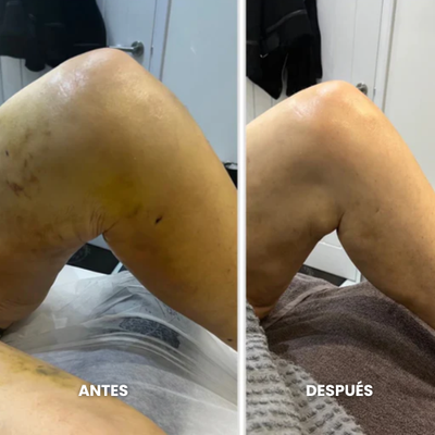 Gotas de Bienestar para Drenaje Linfático
