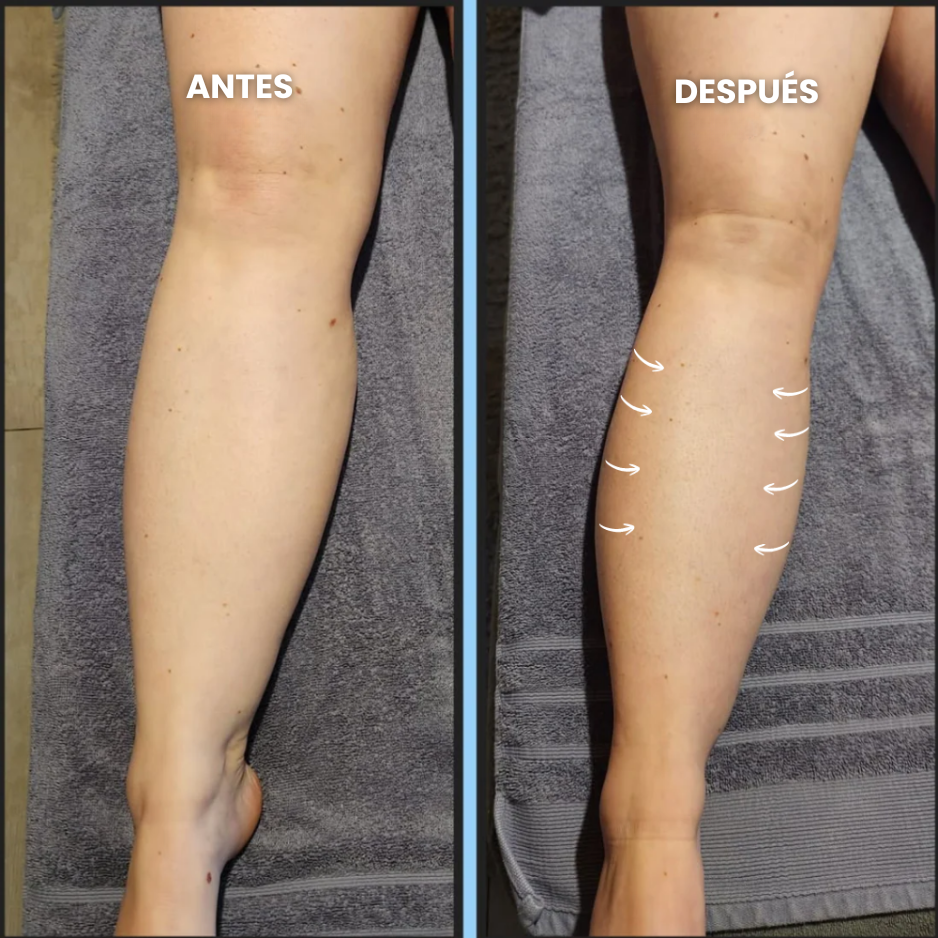 Gotas de Bienestar para Drenaje Linfático