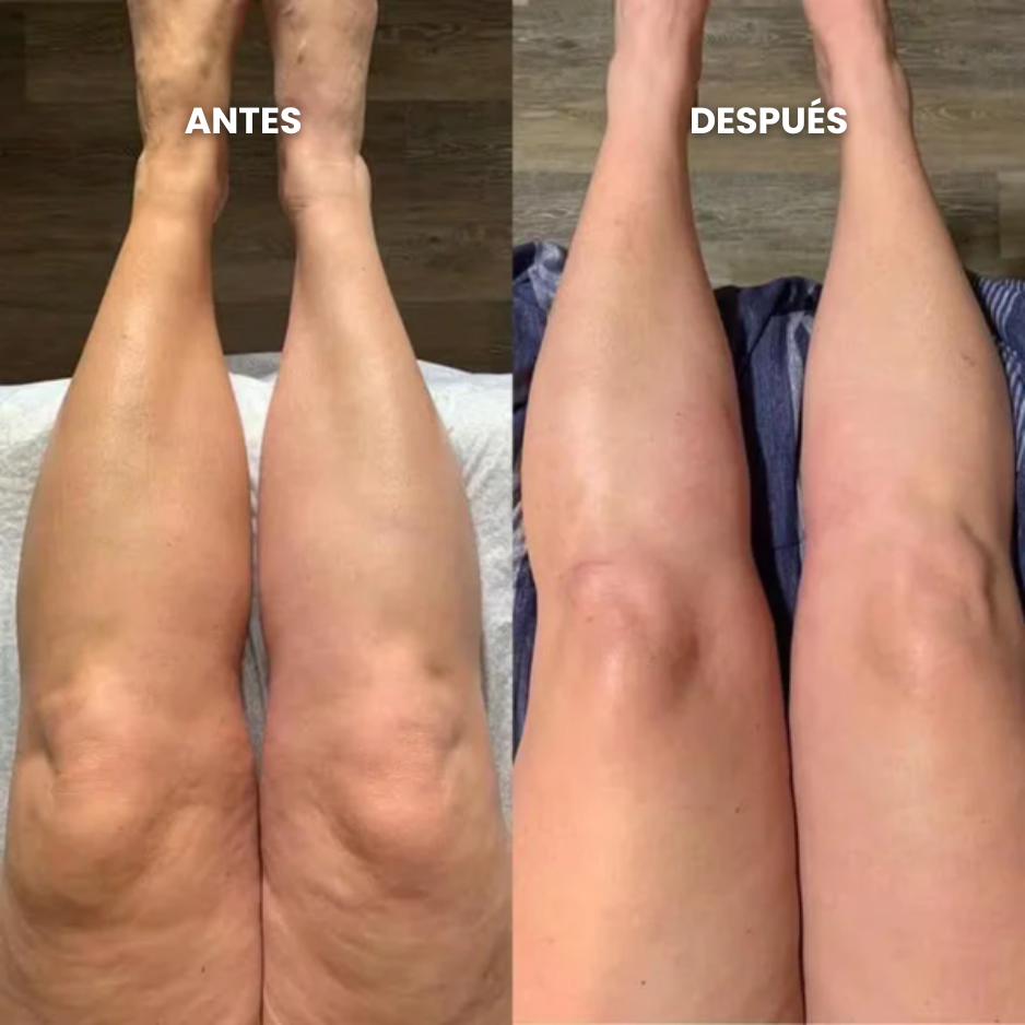 Gotas de Bienestar para Drenaje Linfático