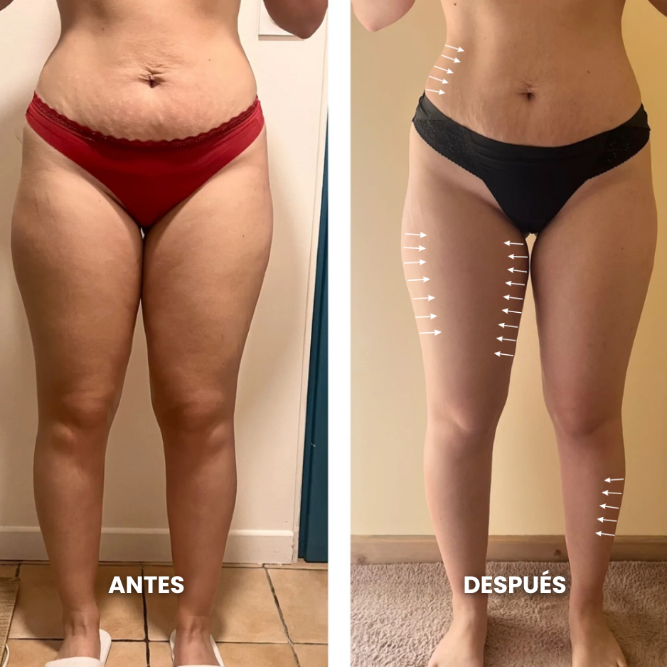 Gotas de Bienestar para Drenaje Linfático